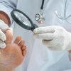 Photo for Global Onychomycosis (Tinea Unguium) Drug  Market Forecast to 2023
