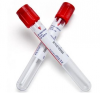 Photo for Global Vacutainer Market Forecast to 2023