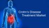 Photo for Crohn’s Disease Treatment Market – Comprehensive Market Study with Focus on Key Drivers and Trends