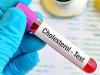 Photo for Cholesterol Testing Services Market is expected to Garner US$ 22.6 Bn by 2025