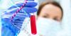 Photo for Molecular Diagnostics Market 2018-2025: New Technology and Improvements in the Healthcare Sector