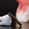 Photo for Richard's Dental Ceramics Inc