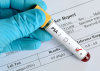 Photo for Global PSA Test Market Forecast to 2023