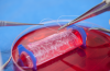 Photo for Global Tissue Engineering Market Forecast to 2023