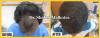 Photo for best hair transplant surgeon in delhi