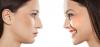 Photo for Best Rhinoplasty surgeon in delhi