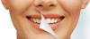 Photo for Restore Your Pearly Whites with Teeth Whitening Services