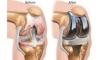 Photo for total knee replacement surgeon in delhi