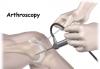 Photo for arthroscopy surgeon in delhi