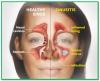 Photo for Ayurvedic Treatment for Sinus