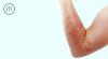 Photo for ayurvedic treatment for skin allergy