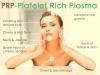 Photo for platelet rich plasma for hair loss in delhi
