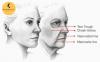 Photo for Dermal Fillers in Delhi