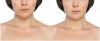Photo for Hair Today And Gone Tomorrow Here’s How To Lose It