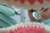 Photo for Global Indirect Restorative Materials of Dental Consumables Market Forecast to 2023