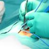 Photo for Biosurgery Market Growth and Demand Forecast to 2023