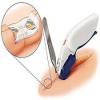 Photo for Global Surgical Stapplers Market Research Report 2018