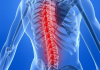 Photo for Global Spinal Trauma Devices Market 2018 Forecast to 2023