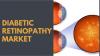 Photo for The Diabetic Retinopathy Market is recurring & impressive growth generating sector