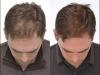 Photo for Shapiro MD Shampoo : increase your Hair Growth