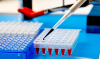Photo for Global Enzyme-Linked Immunosorbent Assay (ELISA) Market 2018 Forecast to 2023