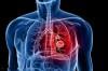 Photo for Pulmonary Drug Delivery Systems Market - Key Players, Industry Overview, Supply Chain and Analysis to 2018-2022
