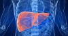 Photo for Primary Biliary Cirrhosis Drugs Market - Global Industry Insights, Trends and Opportunity Analysis 2017-2025