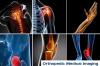Photo for Orthopedic Medical Imaging Market - Global Industry Insights, Trends and Analysis, 2017-2025