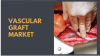 Photo for Vascular grafts Market to Reach USD 4.2 billion by the End of 2025