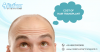 Photo for Best hair Transplant Cost in Delhi, India