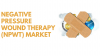 Photo for The Negative Pressure Wound Therapy (NPWT) Industry is set to experience revolutionary growth in near future