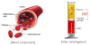 Photo for Global Platelet Rich Plasma (PRP) Market 2018 Forecast to 2023