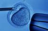Photo for Treatments Before IVF