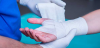 Photo for Global Advanced Wound Care Market 2018 Forecast to 2023