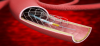 Photo for Global Coronary Atherectomy Devices Market 2018 Forecast to 2023