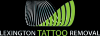 Photo for Lexignton Tattoo Removal