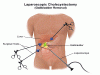 Photo for General And Laparoscopic Surgeon In Aurangabad - Mundada Urology Hospital Aurangabad