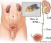 Photo for Kidney Specialist In Aurangabad - Mundada Urology Hospital Aurangabad