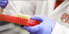 Photo for Global Technical Enzymes Market 2018 Forecast to 2023