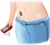 Photo for Global Artificial Pancreas Devices Systems Market 2018 Forecast to 2023