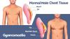 Photo for Male Breast Reduction Guide for Sculpt India