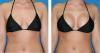 Photo for Their Breasts Changed Shape following Pregnancy