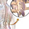 Photo for Global Body Reconstruction Product Market Overview – Key Futuristic Trends and Competitive Landscape 2023