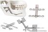Photo for Distraction Osteogenesis Devices Market to Surpass US$ 317.1 Million by 2025