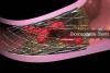 Photo for Bioabsorbable Stents Market -Global Industry Insights, Trends, Size, Analysis and Forecast to 2025