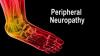 Photo for Arizona K-Laser Neuropathy Center
