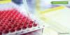 Photo for Cell-Based Assays Market Growth Drivers and Restraints, Current & Future Opportunity and Insights by Geography