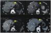 Photo for HIFU Prostate Cancer Ultrasound Treatment California Doctor Germany Clinic