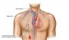 Photo for Global Intravenous Access Devices Market Research Report: Market Competition Trend and Price by Manufacturers till 2021