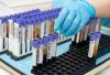 Photo for Biobanking Market by Product and Service, Sample Type, Application & Storage Type | Global Research Report, 2013-2023